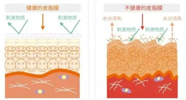 化妆品,皮肤,保湿,皮肤干燥,成分,角质层